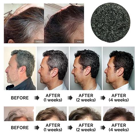 Visible Results After 3 Weeks. . Mane grey reverse bar reviews hair loss